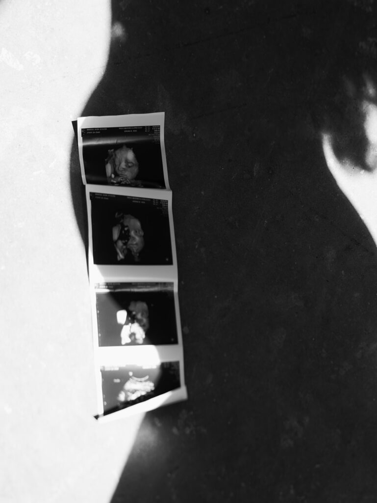 shadow of pregnant stomach and a sonogram during a studio maternity session